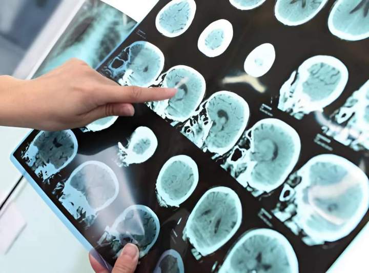 Expert en radiologie Veauche