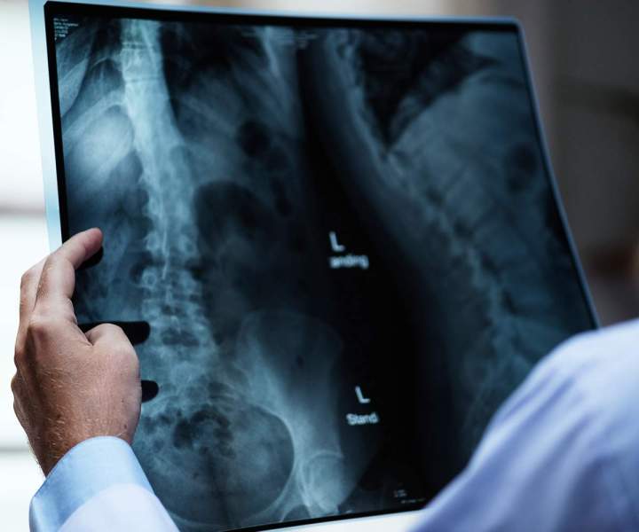 Radiologie Veauche