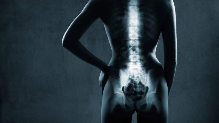 Matériel de radiologie Veauche